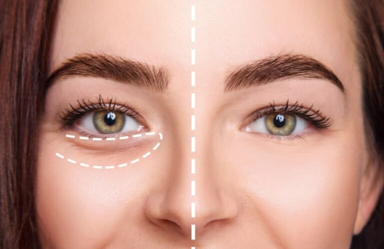Expert Tips For Youthful and Smooth Under Eyes Hollows Expert Tips For Youthful and Smooth Under Eyes Hollows
